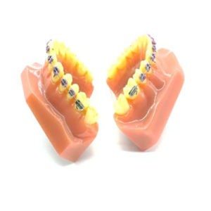 ADDLER Dental Ortho Teeth Model