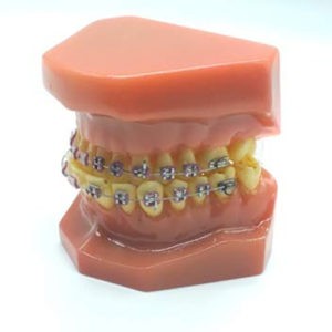 ADDLER Dental Ortho Teeth Model